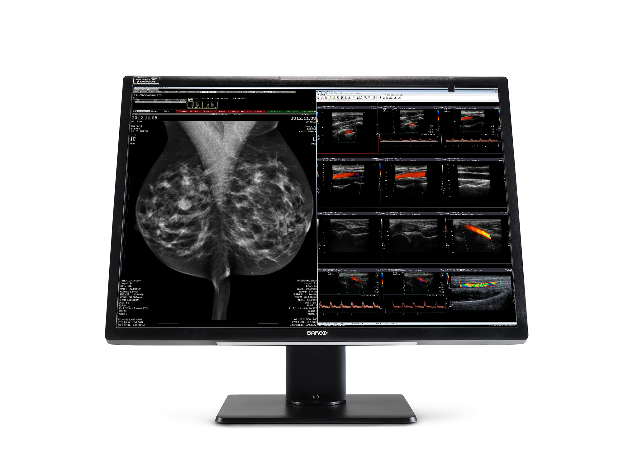 Nio Fusion 12MP MDNC-12130 — Barco — Diagnóstico