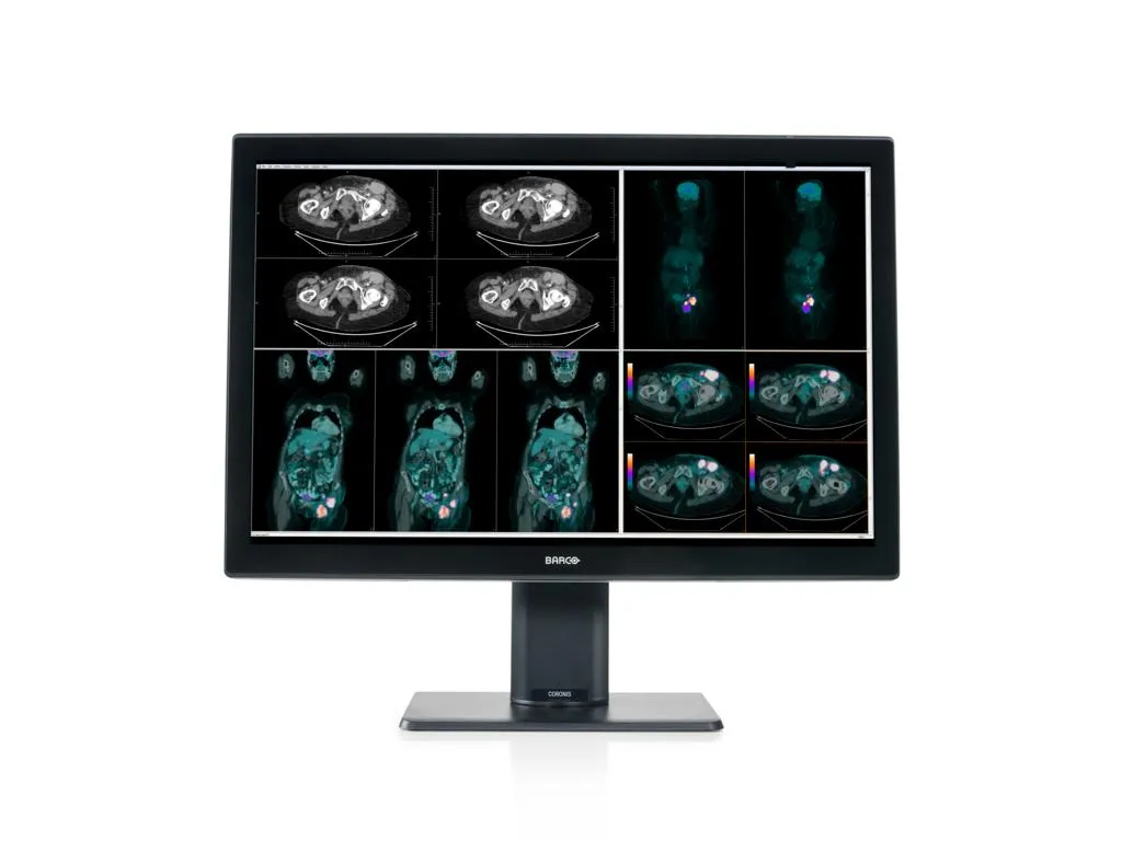 Coronis Fusion 4MP MDCC-4430 — Barco — Diagnóstico