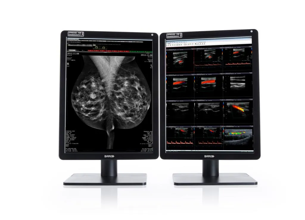 Nio Color 5.8MP MDNC-6121 — Barco — Diagnóstico