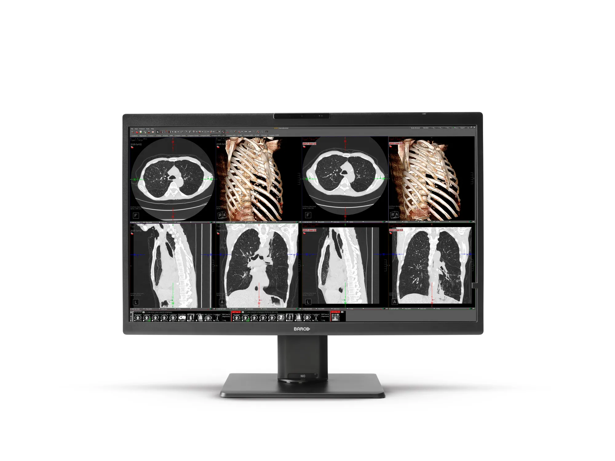 Nio Color 8MP MDNC-8132 — Barco — Marcas
