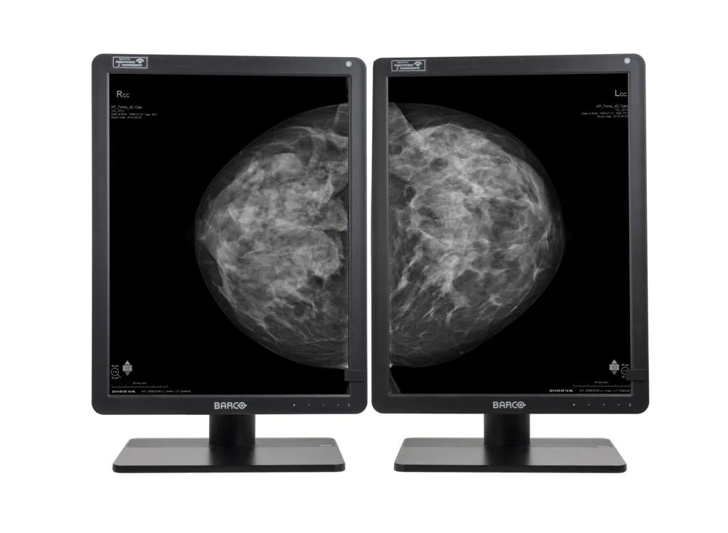Nio Gris 5.8MP MDNG-6221 — Barco — Marcas